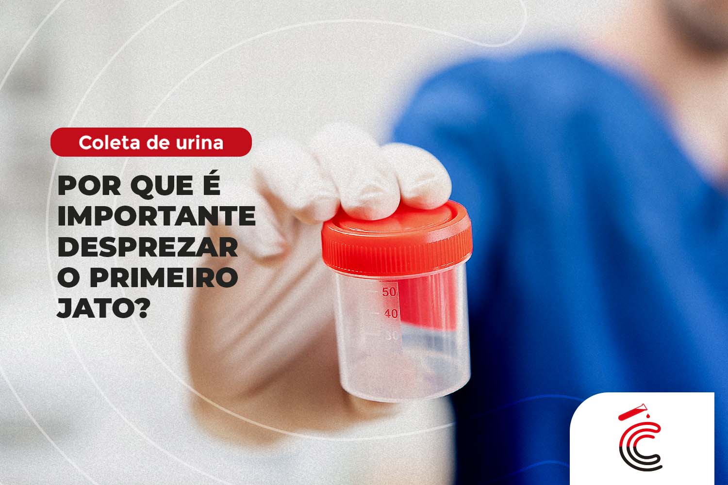 Coleta de urina: Por que é importante desprezar o primeiro jato?