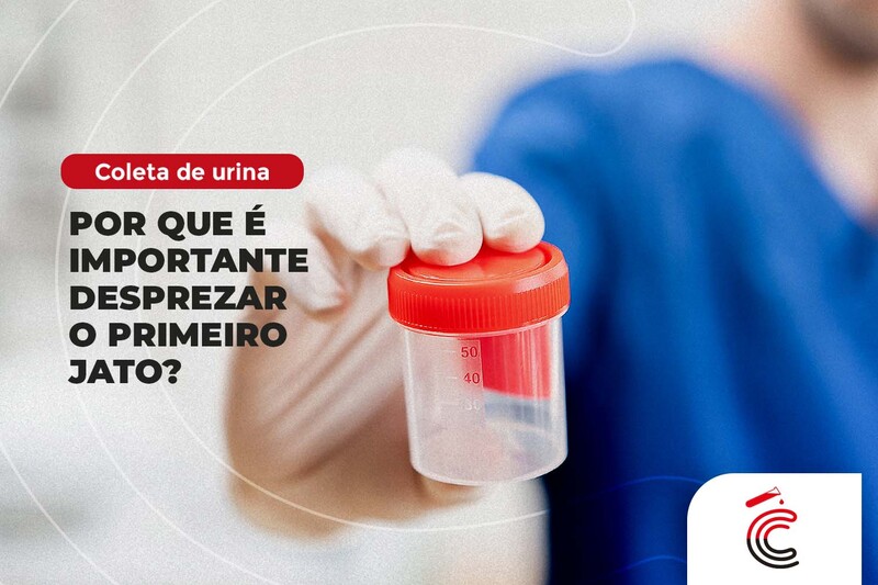 Coleta de urina: Por que é importante desprezar o primeiro jato